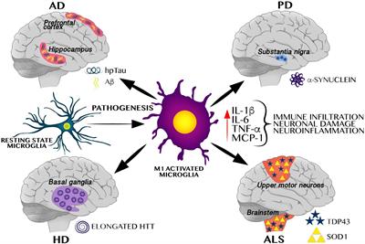 Neurodegenerative Susceptibility During Maternal Nutritional Programing: Are Central and Peripheral Innate Immune Training Relevant?